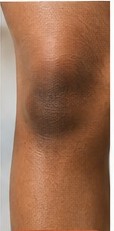 Knees