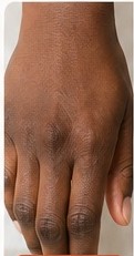 Knuckles