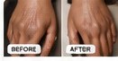 Dark knuckles before and after