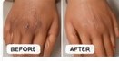 Dark knuckles before and after