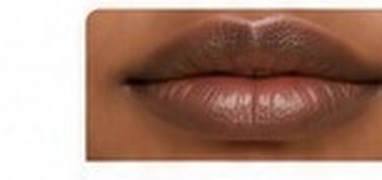 Diffuse Pigmentation