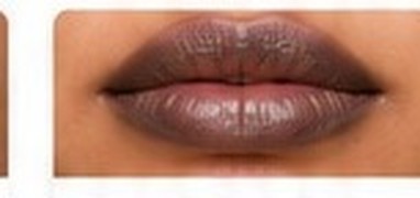 Outer Rim Pigmentation