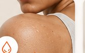 Dry Skin