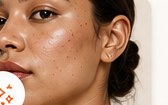 Dull Skin
