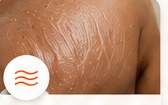 Scars & Stretch Marks