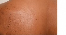 Body Brightening