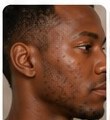 Michael, 29 before