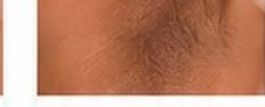 Frictional Pigmentation