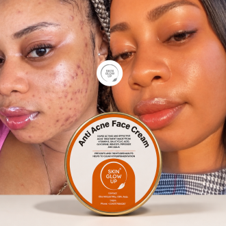 Anti Acne Face Cream
