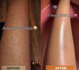 Beige Minimalist Bold Beauty Skincare Before After Collage Instagram Post - 3
